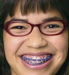 uglybetty